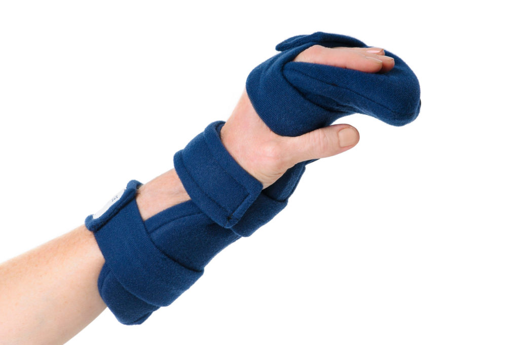 Wrist Finger Extension Splint at Janice Unger blog